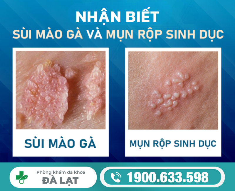 Hình ảnh minh họa